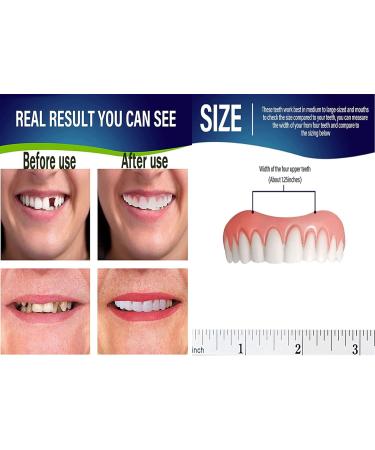 Temporary Tooth Repair Kit | Thermal Bonding Accessories | Women's Veneers | Upper & Lower Teeth | Restore Confidence | Beauty Teeth - Buy Online on GoSupps.com