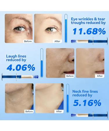 POYICGS Luxev ria Polypeptide Collagen Elastic Essence Cream 2026 New Micro-Molecular Collagen Anti-Wrinkle Lotion Polypeptide Collagen Firming Cream Tightening Lifting - Buy Online on GoSupps.com