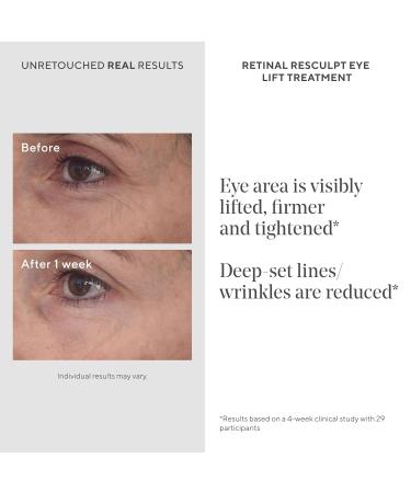 Murad Retinal ReSculpt Eye Lift Treatment - Age-Defying Eye Cream with Encapsulated Retinal Gentian Root & Oat-Firming Film for Youthful Eyes - Tightens Droopy Lids & Under-Eye Bags - 0.5 Fl Oz - Buy Online on GoSupps.com