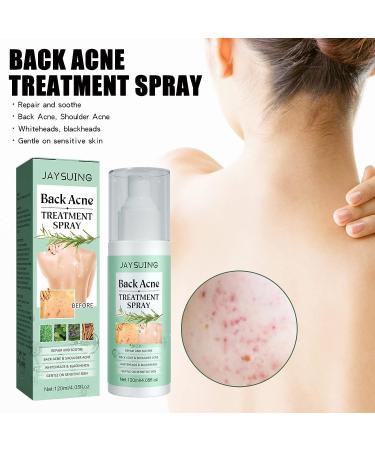 DICTAMNI Back Acne Treatment Spray - Herbaluxy Tea Tree Oil Body Acne Solution 2PCS - Buy Online on GoSupps.com