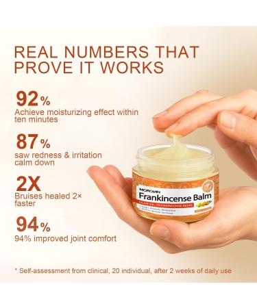 Morovan Elderly Bruise Balm Frankincense: Soothing Skin Balm for Appearance of Bruises & Joint Muscle Discomfort, Helps Promote Comfort & Relaxation for Men & Women - Buy Online on GoSupps.com