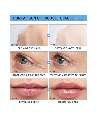 AllbestAye Hyaluronic Acid Lip Balm & Plumper - 100% Natural Beeswax & Jojoba Oil Lip Care Stick (#01) - International Shipping Available - Buy Online on GoSupps.com