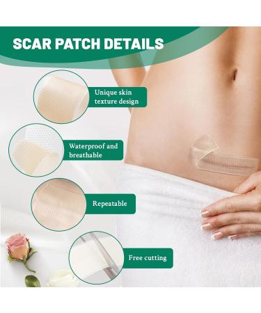 3 Rolls Silicone Scar Sheets(1.6" x 60" Each) Silicone Patches for Scars Reusable Scar Removal Strips for Prevention and Repair - Buy Online on GoSupps.com