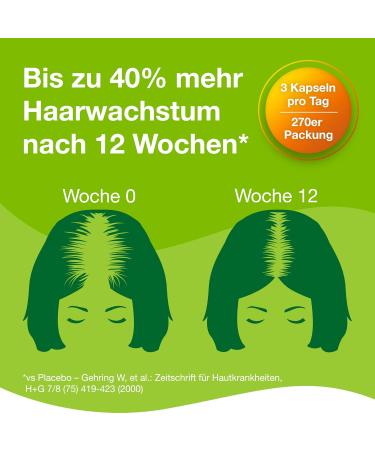 Priorin Capsules for Women's Hair Loss - 30 Capsules | Hormonally Hereditary Hair Growth Solution - International Shipping Available - Buy Online on GoSupps.com