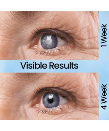 Moisturizing Eye Drops for Cataract & Glaucoma Relief | Antioxidant Dry Eye Solution (10 Pack) - Buy Online on GoSupps.com