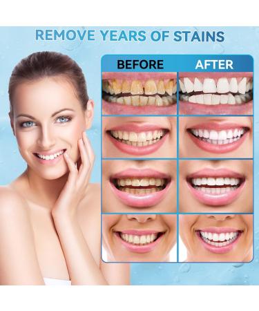 Teeth Whitening Pen 2 Pcs - Stain Remover for Whiter Teeth | Whitening Gel Pen for Home & Travel | 20+ Uses | Easy, Painless & Sensitivity-Free | Mint Flavor | 2 Count - Buy Online on GoSupps.com