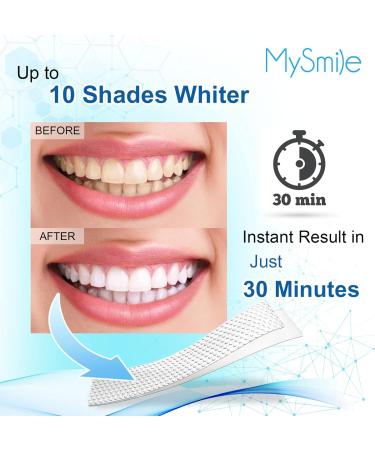 MySmile Teeth Whitening Kit - 14 Non-Sensitive Strips for Fast, Natural Whitening - Buy Online on GoSupps.com
