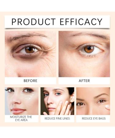  Ziennhu Eye Revitalizer - Repair Cream - Repair Cream for the Eye Contour - Eye Contour Moisturizing Roll-On Serum Intensive Eye Contour Roller Soothes the Eye Contour Brightening - Buy Online on GoSupps.com