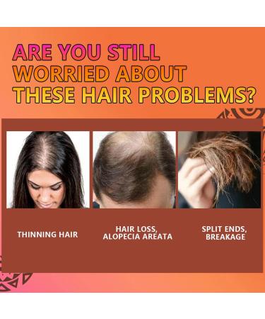  Generisch Anti-hair loss shampoo bar for hair growth anti-hair loss shampoo bar | Shampoo bar for a healthy and shiny look | Deep moisturizing conditioner bar - Buy Online on GoSupps.com