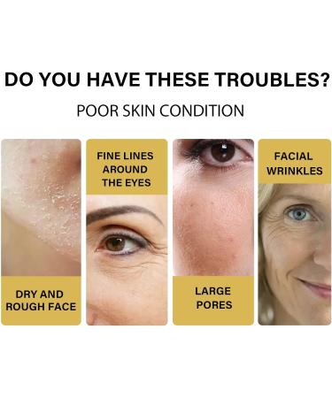  Nexolla Lifting Collagen Thread Absorbable Collagen Thread Lifting Set Protein Thread Reduction Wrinkles Skin Moisturizing Firming (15ml+20PCS) - Buy Online on GoSupps.com