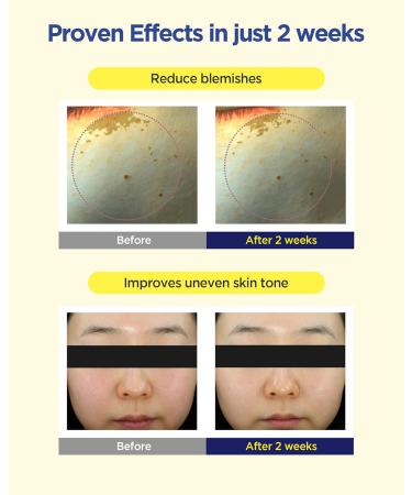 CKD Vita C Teca Blemish Shot Mask - Hydrogel Firming Face Mask with Pure Vitamin C & Centella Asiatica for Radiance & Dark Spot Relief - 5 Sheets - Buy Online on GoSupps.com