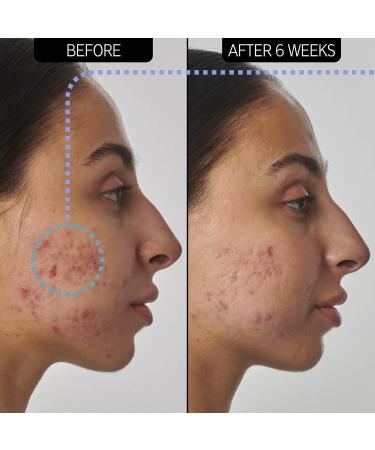 The Inkey List Retinol 1% Serum 30ml | Supersolutions | Targets Scars and Wrinkles | Fragrance-free | Suitable for Normal/Oily Skin - Buy Online on GoSupps.com