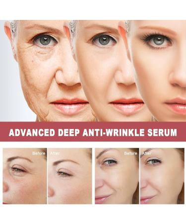 (My Favorites) KYOSK Advanced Deep Anti-Wrinkle Serum Anti Wrinkle Deep Wrinkle Serum Anti-Aging Collagen Dark Spot Corrector Advanced Deep Anti-Wrinkle Serum for All Skin Types 30ml/1.01fl.oz (3pcs) - Buy Online on GoSupps.com