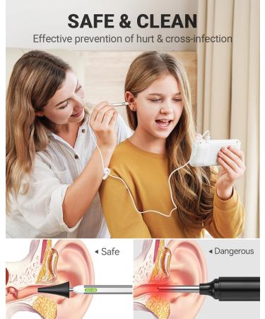 Anykit Digital Otoscope with Gyroscope, 4 Inches Screen, 3.9mm Ear Scope Camera with 6 Lights, Ear Wax Removal Tool, 32GB Card, Supports Photo Snap and Video Recording - Buy Online on GoSupps.com