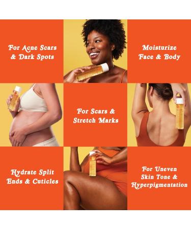 Bio-Oil Natural Skincare Oil Serum Face and Body Moisturizer with Chamomile Rosehip and Lavender Oil for Scars Stretch Marks Sensitive Skin All Skin Types 0.85 Oz Pack of 3 0.85 Fl Oz (Pack of 3) - Buy Online on GoSupps.com