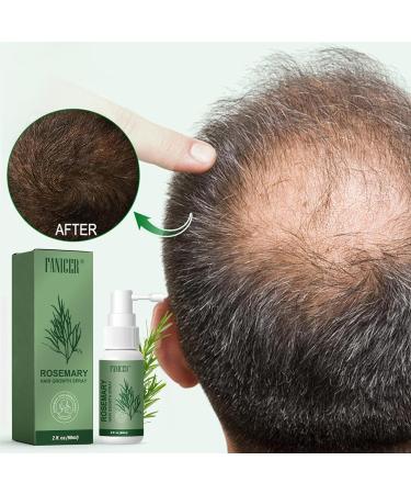 2 * 60ml hair serum hair growth serum hair growth oil hair loss for women anti hair loss for men Promotes Hair Growth - Buy Online on GoSupps.com