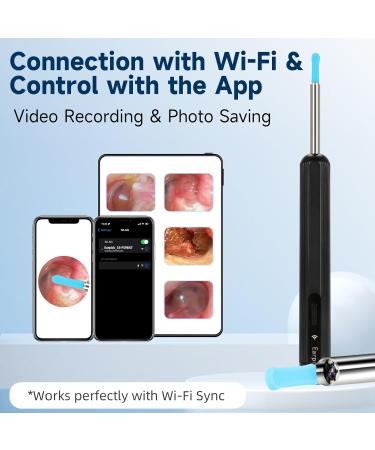 Smart Ear Wax Removal Tool with Camera & Light | Effective Ear Cleaner Kit for Kids & Adults - Buy Online on GoSupps.com