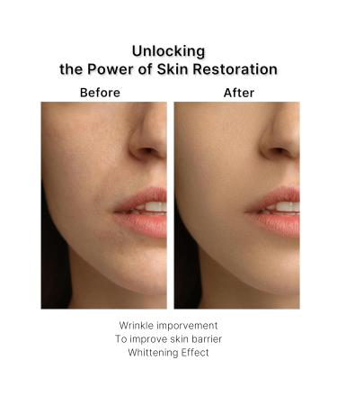 Buy Peptide 11 Botulinum Multi Recovery Ampoule 30ml - Anti-Aging Skin Treatment for Global Shipping - Buy Online on GoSupps.com