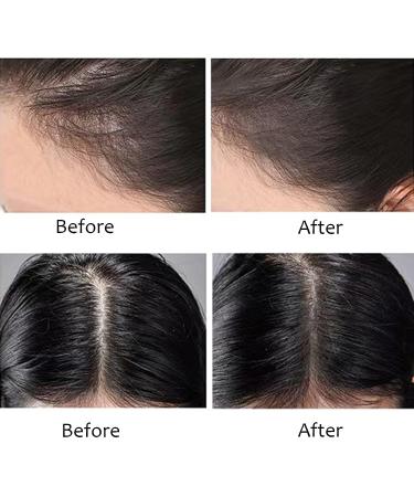 Rosarden Hairline Powder Stick - Waterproof Hair Loss Concealer for Women & Men (Dark Brown) - Buy Online on GoSupps.com