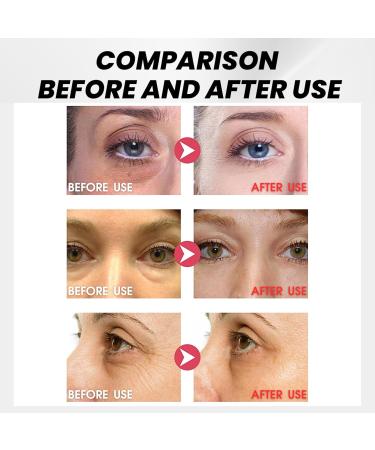 Eye Tightening Cream Instant Instant Firming Eye Cream for Dark Circles and Puffy Eyes Eye Firming Cream Instant Eye Bag Cream Under Eye Cream for Eye Bag Remover Anti Aging Fine Lines 15ml - Buy Online on GoSupps.com