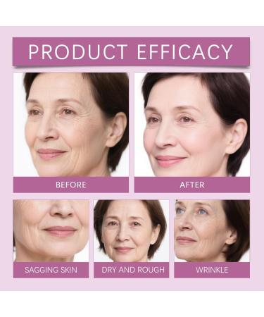 Calcium Multi Balm Skin Barrier Repair Cream Moisturing Stick Firming & Moisturizing Hydrating Moisturizing Cream Suitable for Face Eyes Neck (1pcs One size) 1pcs 1 Fl Oz (Pack of 1) - Buy Online on GoSupps.com
