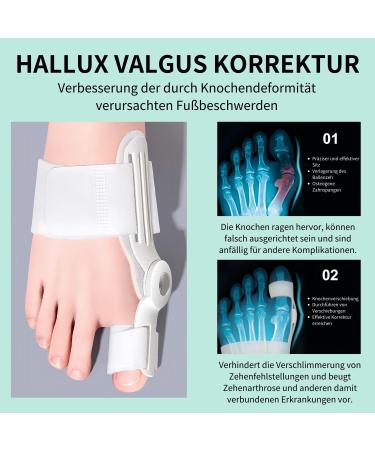 Melarqt Adjustable Hallux Valgus Correction Rail - Unisex Big Toe Straightener for Day & Night Relief (Left/Right Foot) - Buy Online on GoSupps.com