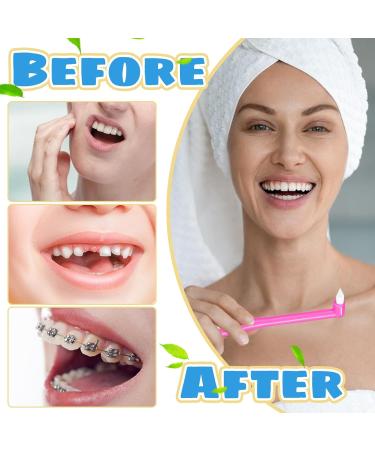 8 Pcs Interspace Toothbrush Soft Single Tufted Toothbrush with Cover Slim Interspace toothbrushes interdental Brushes for Orthodontic Braces Detail Cleaning(Blue/Green/Rose Red/White) - Buy Online on GoSupps.com