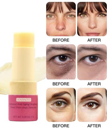 0.5% Retinol Eye Stick Eye Brightener Balm Retinol Eye Cream With Hyaluronic Acid Eye Cream for Dark Circles and Puffiness Visible Results in 1-2 Weeks Anti Aging Under Eye Cream for Wrinkles and Bags Reduces Fine Lines 7g 7 g (Pack of 1) - Buy Online on GoSupps.com