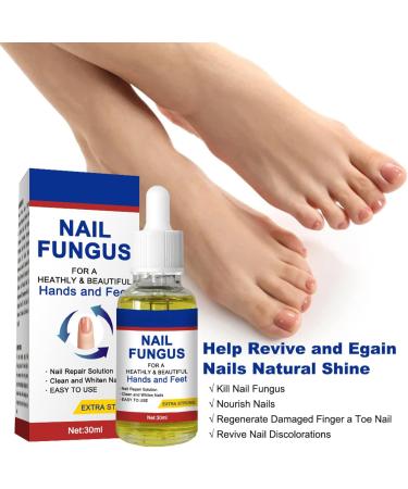 Nail Fungal Treatment Toenail Treatment Extra Strong Nail Repair Set Fingernail Toenail Care Fix Renew Damaged Broken Anti Fungus Nail Repair - Buy Online on GoSupps.com