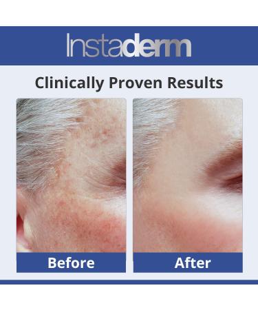 Best Dark Spot Corrector Cream | Naturally Fade Dark Spots Sun Spots & Acne Scars | Face & Body Treatment - Buy Online on GoSupps.com