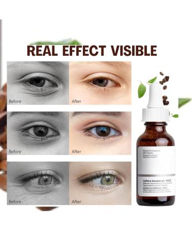 Caffeine Eye Serum Caffeine Solution 5% + EGCG Eye Serum For Dark Circles Caffeine Eye Cream for Anti Aging Wrinkle Lift Eye Line Eye Bags Removal-Firming and Plumping of Skin All Skin Types - Buy Online on GoSupps.com