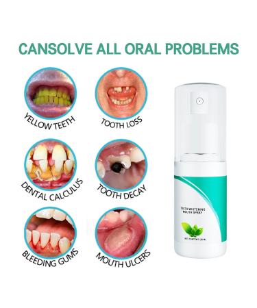 3PCS Teeth Whitening Spray - Stain Removal Prevent Tooth Decay & Freshen Breath | 30ml Dental Care - Buy Online on GoSupps.com