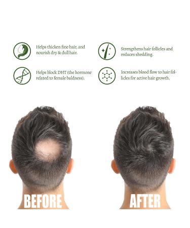 ATIVO Wellness Sangre De Grado Hair Growth Shampoo - 500ml with Rosemary & Nettle Extract - Buy Online on GoSupps.com