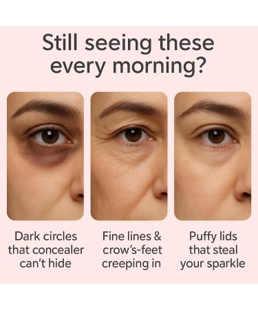 Mtmult Eye Cream Anti Aging Salmon DNA PDRN Pink Peptide Skin Care with 5% Niacinamide Retinol Peptides Sodium Hyaluronate | Eye Treatment for Fine Lines Dark Circles | 1.01fl.oz - Buy Online on GoSupps.com