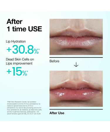 Anua PDRN Lip Serum Long-lasting Hydration for Dry Cracked Lips Non-Sticky Moisturizing Lip Care with Salmon DNA Hyaluronic Acid & Collagen Korean Skincare 0.33 fl.oz - Buy Online on GoSupps.com
