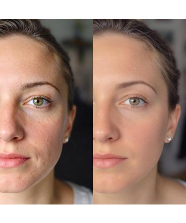 Advanced Retinol 100% Organic Intensive Anti-Aging Treatment Cream 2.5% Active Retinol Moisturizer for Face & Neck Reduces Wrinkles Improves Skin Texture and Firmness 50ml / 1.7 fl. oz. (1) - Buy Online on GoSupps.com