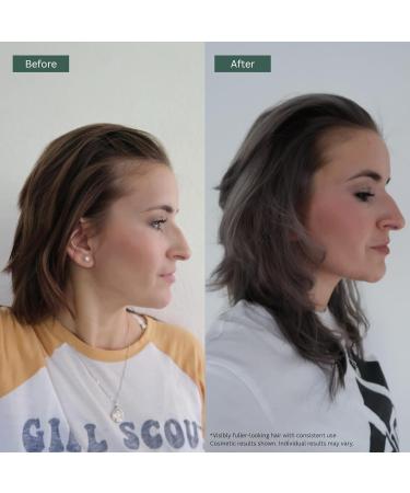 Regrowz Shampooing paississant pour cheveux au palmier nain beurre de karit biotine noix de coco argon huile de romarin bio et v g talien 225 ml 225 ml (Lot de 1) - Buy Online on GoSupps.com