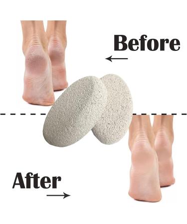 Buy 2 Pieces Natural Pumice for Feet & Body Care | Effective Pedicure Tools for Dead Skin Peeling - Buy Online on GoSupps.com