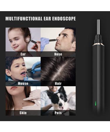 Puikos Ear Wax Removal 1296P FHD Otoscope with 6 LED Light & 4 Ear Spoons - Wireless Earwax Cleaner for iPhone, iPad, Android - Black - Buy Online on GoSupps.com