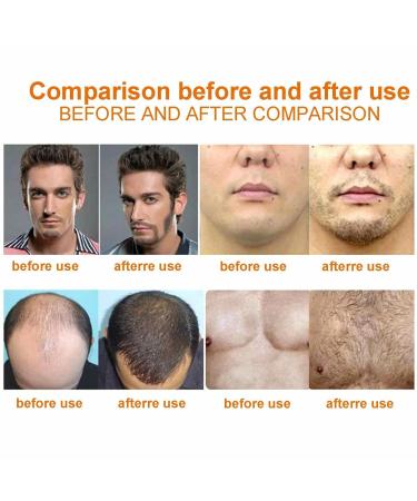 Natural Beard Oil - Bart l for Softness & Strength | Men's Beard Treatment & Perfect Gift - Buy Online on GoSupps.com