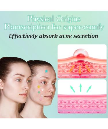 Star Pimple Patches - 240 Hydrocolloid Acne Dots with Tea Tree Oil | 3 Sizes & 6 Colors for Blemish Relief - Buy Online on GoSupps.com