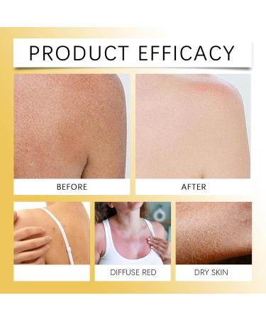 Vitamin E Body Oil Vitamin E Oil Firming Oil For Skin RejuvenationBody Moisturizer Body Oil Nourishes Dry Softens And Smoothes Hand Crafted Body Oil (1) - Buy Online on GoSupps.com