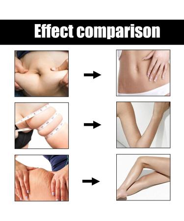Active Plant Supplements - Cellulite Massage Oil for Fat Reduction & Improved Circulation | Non-Greasy Texture - Buy Online on GoSupps.com