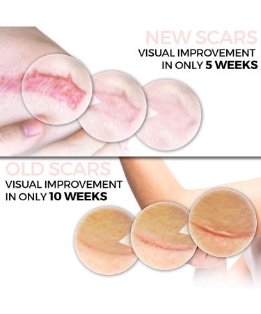 Scarbandit Advanced Scar Gel - Non-Sticky Silicone for Keloid, Stretch Marks, Acne & Surgical Scars - 45g - Buy Online on GoSupps.com