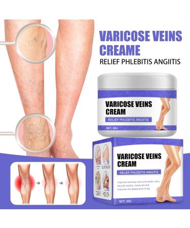 Varicose Veins Cream - Herbal Ointment for Leg Fatigue - Improve Circulation and Eliminate Spider Veins (30g) - Buy Online on GoSupps.com