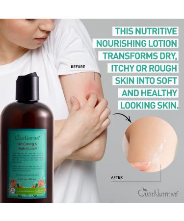 Just Nutritive Skin Calming & Healing Lotion - Organic Moisturizer for Dry, Cracked, Irritated, and Itchy Skin - Eczema Relief - 16 Oz - Buy Online on GoSupps.com
