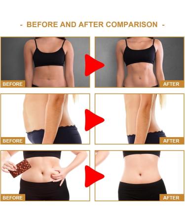 Buy Slimming Patches for Fast Weight Loss | Belly Fat Burning & Anti-Cellulite Solution - International Shipping - Buy Online on GoSupps.com