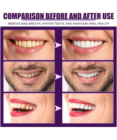 Mint Concentrated Mouthwash - 59ml | Fresh Breath & Plaque Removal | Plant Extract Formula - Safe & Effective - Buy Online on GoSupps.com