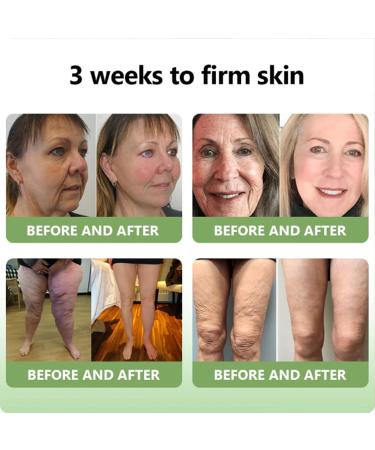 Furzero Luxurious Collagen Peptide Firming Cream Luxurious Collagen Firming Cream Collagen Anti-Wrinkle Cream Moisturizing Face and Body Care Cream (1PC) - Buy Online on GoSupps.com