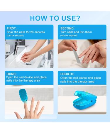 iKeener Nail Fungus Laser Treatment Device - Home Use Pain-Free Fungi Nail Remover for Fingernails & Toenails - Clean, Repair, and Cure Nail Fungus in Just 7 Minutes a Day - Don't Be Embarrassed Again! (Blue) - Buy Online on GoSupps.com